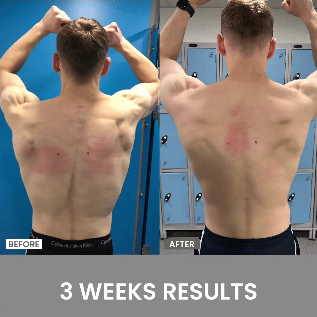 Posture Corrector – Instantly Improve Your Posture! (Buy 1, Get 1 Free)