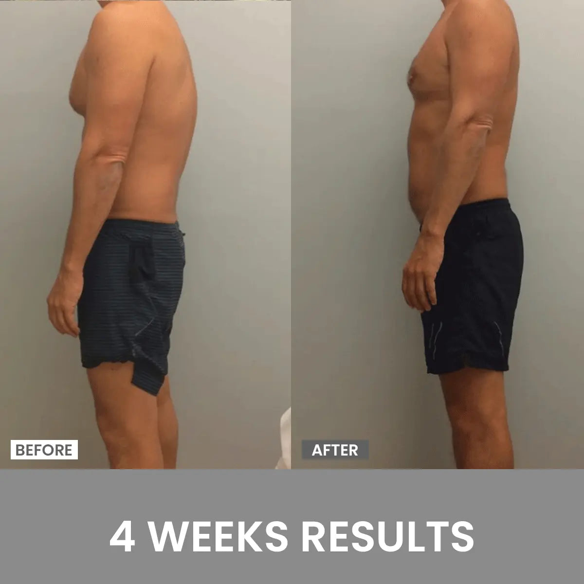 Posture Corrector – Instantly Improve Your Posture! (Buy 1, Get 1 Free)